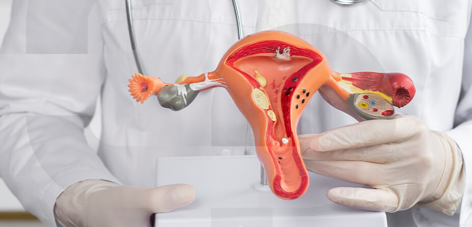 Imagem Câncer Ginecológico