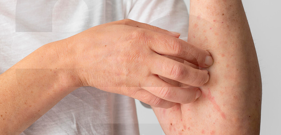 Imagem Câncer de Partes Moles